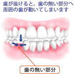 歯の動き